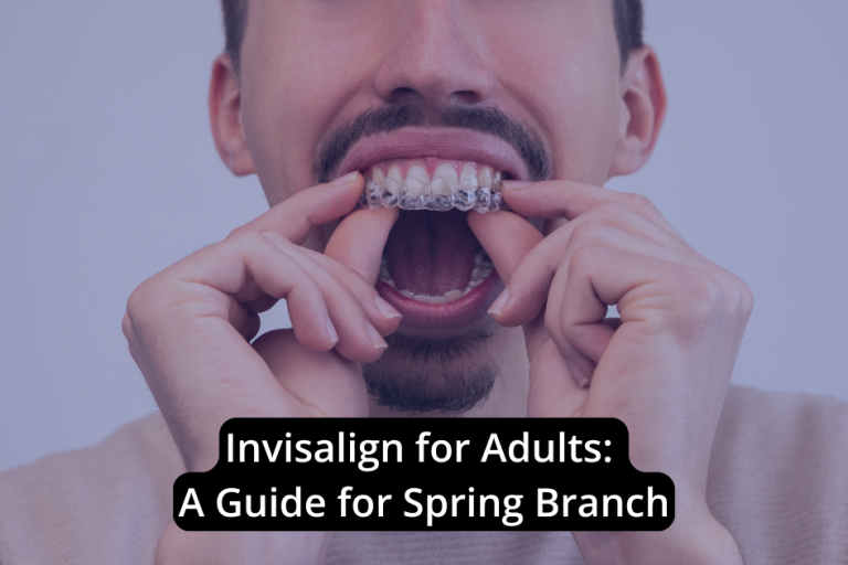 A man inserts a clear Invisalign aligner onto his upper teeth. Text reads: "Invisalign for Adults in Spring Branch: A Guide.