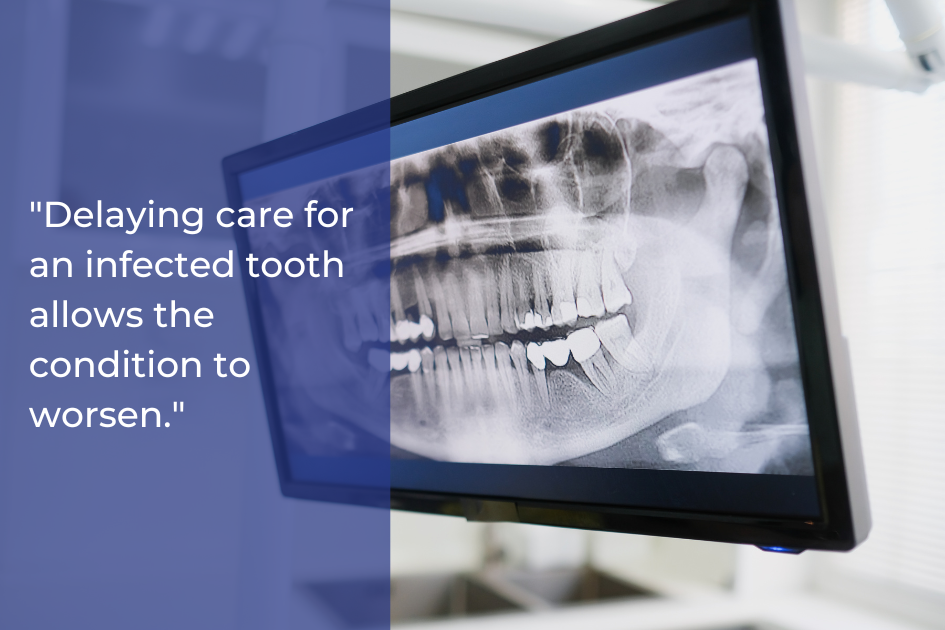 A dental X-ray is displayed on a monitor next to a quote stating, "Delaying care for root canal symptoms allows the condition to worsen.